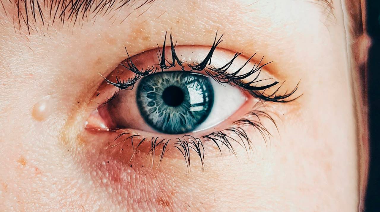 secheresse oculaire